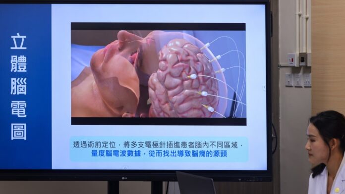 How robotics helped a Hong Kong man with drug-resistant epilepsy